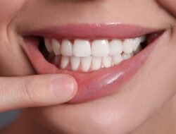 Tips Praktis Memutihkan Gigi di Rumah
